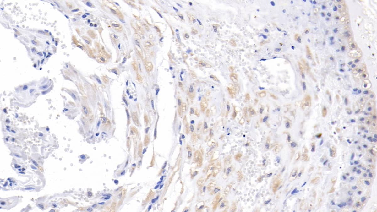 Immunohistochemistry-Paraffin: Activin RIIA Antibody (C8) [NBP3-41966] - DAB staining on IHC-P; Samples: Human Placenta Tissue; Primary Ab: 10ug/ml NBP3-41966; Second Ab: 2ug/mL HRP-Linked Caprine Anti-Mouse IgG Polyclonal Antibody