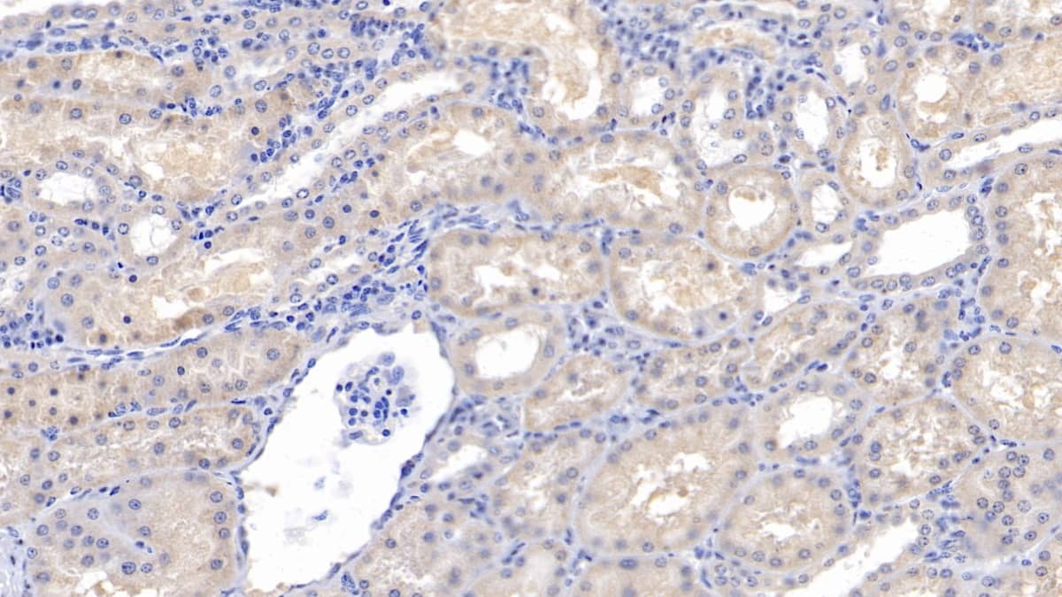 Immunohistochemistry-Paraffin: Activin RIIA Antibody (C8) [NBP3-41966] - DAB staining on IHC-P; Samples: Human Kidney Tissue; Primary Ab: 10ug/ml NBP3-41966; Second Ab: 2ug/mL HRP-Linked Caprine Anti-Mouse IgG Polyclonal Antibody