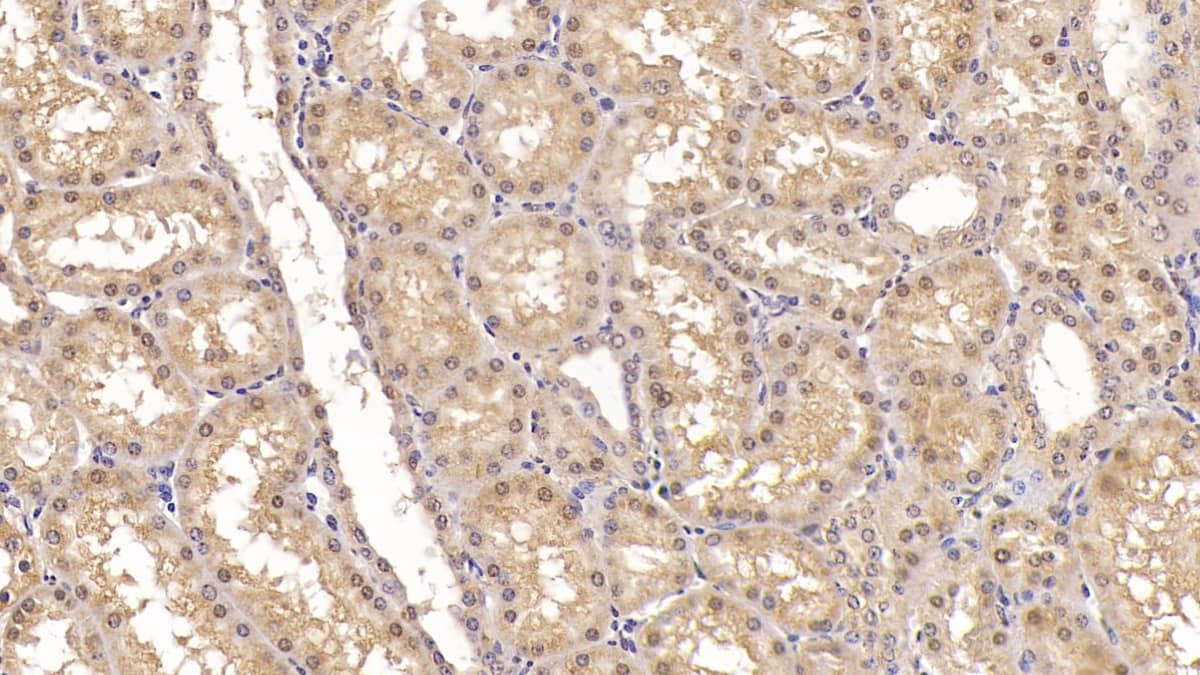 Immunohistochemistry-Paraffin: Activin RIIA Antibody (C1) [NBP3-41967] - DAB staining on IHC-P; Sample: Human Kidney Tissue; Primary Ab: 20ug/ml NBP3-41967; Second Ab: 2ug/mL HRP-Linked Caprine Anti-Mouse IgG Polyclonal Antibody