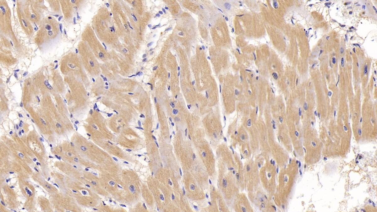 Immunohistochemistry-Paraffin: Activin RIIA Antibody (C1) [NBP3-41967] - DAB staining on IHC-P; Sample: Human Cardiac Muscle Tissue; Primary Ab: 20ug/ml NBP3-41967; Second Ab: 2ug/mL HRP-Linked Caprine Anti-Mouse IgG Polyclonal Antibody