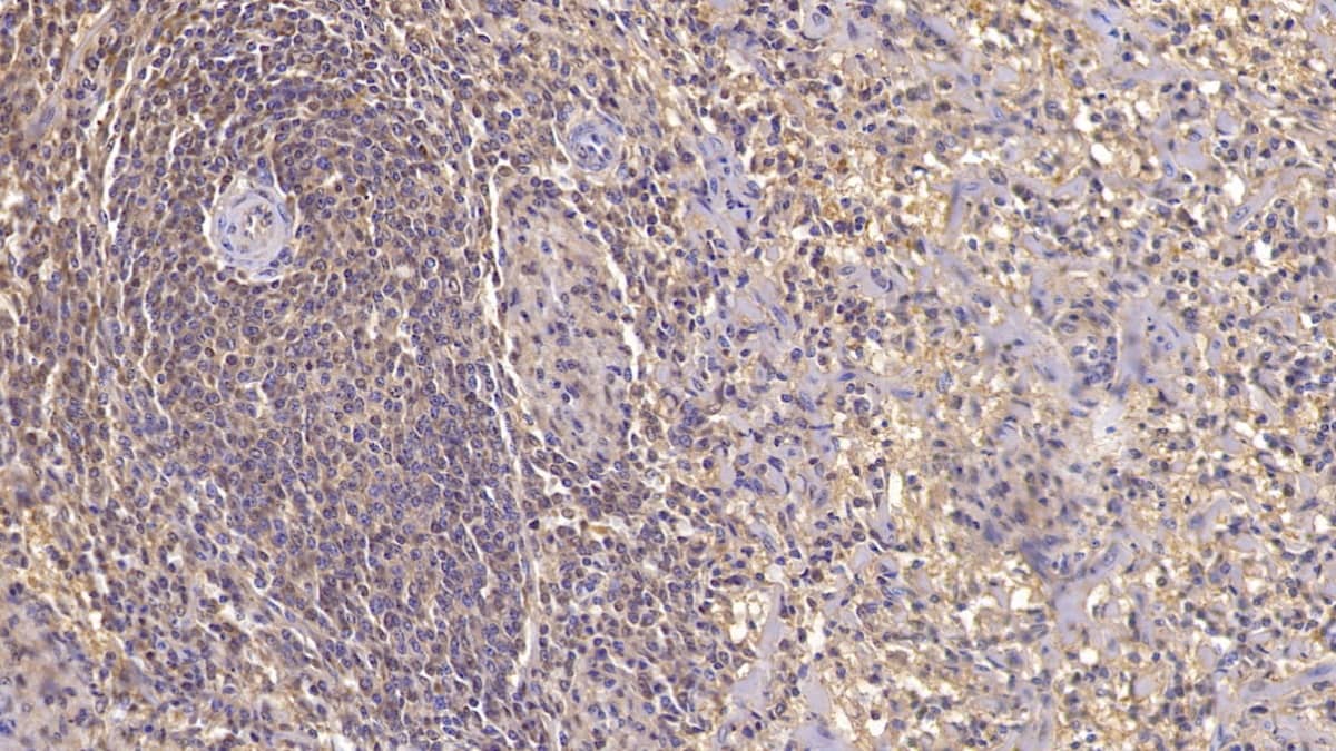 Immunohistochemistry-Paraffin: Activin RIIA Antibody (C1) [NBP3-41967] - DAB staining on IHC-P; Sample: Human Spleen Tissue; Primary Ab: 20ug/ml NBP3-41967; Second Ab: 2ug/mL HRP-Linked Caprine Anti-Mouse IgG Polyclonal Antibody