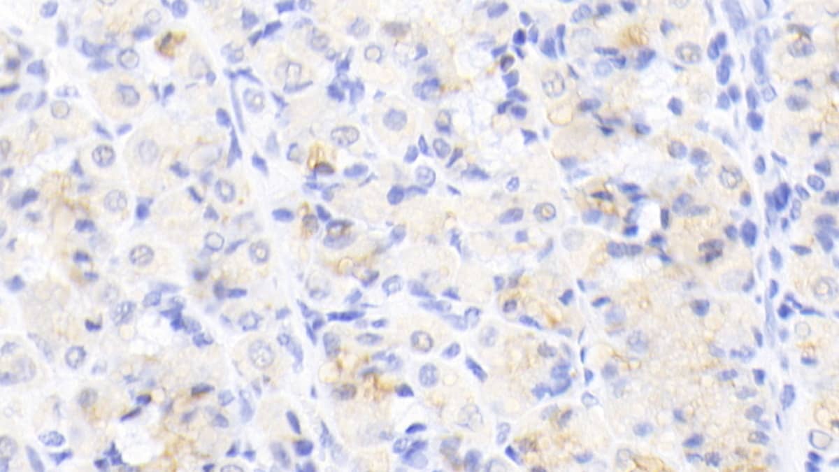 Immunohistochemistry-Paraffin: Activin RIIA Antibody (C7) [NBP3-41968] - DAB staining on IHC-P; Sample: Human Stomach Tissue; Primary Ab: 20ug/ml NBP3-41968; Second Ab: 2ug/mL HRP-Linked Caprine Anti-Mouse IgG Polyclonal Antibody