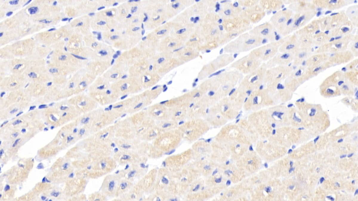 Immunohistochemistry-Paraffin: Activin RIIA Antibody (C7) [NBP3-41968] - DAB staining on IHC-P; Sample: Human Cardiac Muscle Tissue; Primary Ab: 20ug/ml NBP3-41968; Second Ab: 2ug/mL HRP-Linked Caprine Anti-Mouse IgG Polyclonal Antibody