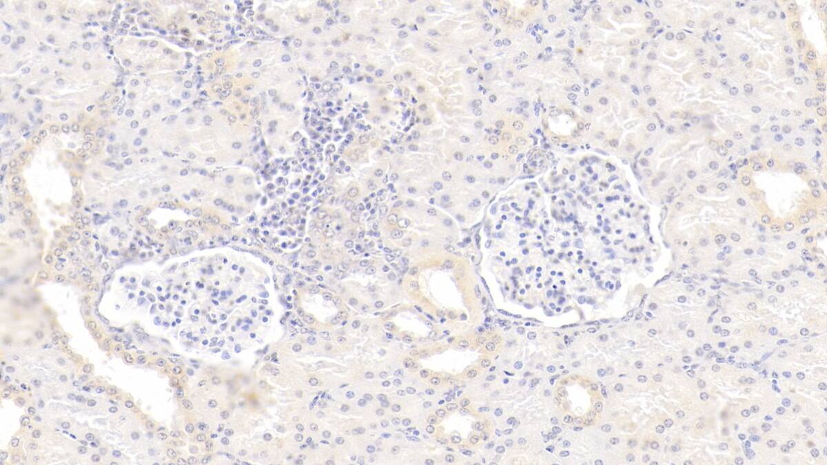 Immunohistochemistry-Paraffin: Gremlin 1 Antibody (D3) [NBP3-41969] - DAB staining on IHC-P; Sample: Human Kidney Tissue; Primary Ab: 20ug/ml NBP3-41969; Second Ab: 2ug/mL HRP-Linked Caprine Anti-Mouse IgG Polyclonal Antibody