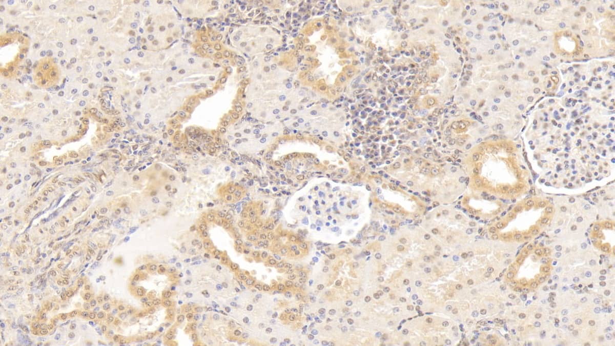 Immunohistochemistry-Paraffin: Gremlin 1 Antibody (D6) [NBP3-41970] - DAB staining on IHC-P; Sample: Human Kidney Tissue; Primary Ab: 20ug/ml NBP3-41970; Second Ab: 2ug/mL HRP-Linked Caprine Anti-Mouse IgG Polyclonal Antibody