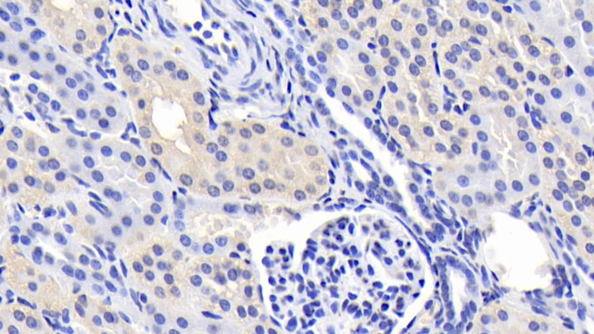 Immunohistochemistry-Paraffin: Phenylalanine Hydroxylase Antibody (C10) [NBP3-41972] - DAB staining on IHC-P; Sample: Human Kidney Tissue; Primary Ab: 20ug/ml NBP3-41972; Second Ab: 2ug/mL HRP-Linked Caprine Anti-Mouse IgG Polyclonal Antibody