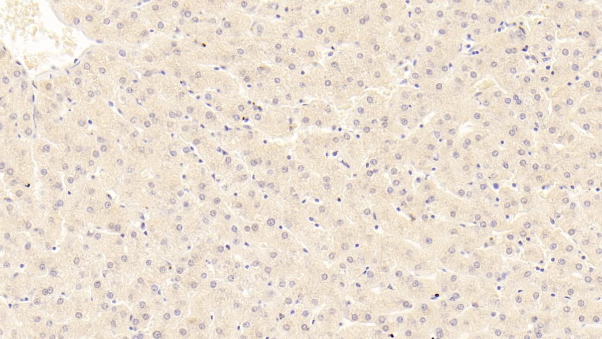 Immunohistochemistry-Paraffin: Phenylalanine Hydroxylase Antibody (C7) [NBP3-41973] - DAB staining on IHC-P; Sample: Human Liver Tissue; Primary Ab: 20ug/ml NBP3-41973; Second Ab: 2ug/mL HRP-Linked Caprine Anti-Mouse IgG Polyclonal Antibody