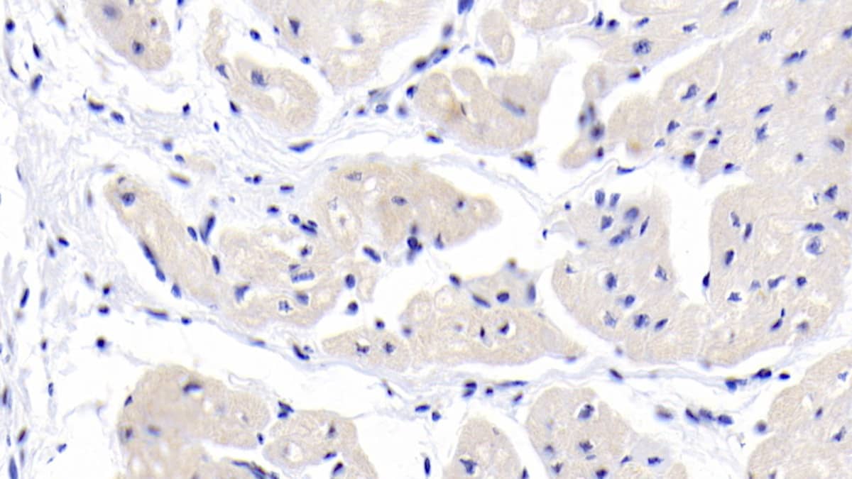 Immunohistochemistry-Paraffin: MYH7 Antibody (C3) [NBP3-41974] - DAB staining on IHC-P; Sample: Human Cardiac Muscle Tissue; Primary Ab: 20ug/ml NBP3-41974; Second Ab: 2ug/mL HRP-Linked Caprine Anti-Mouse IgG Polyclonal Antibody