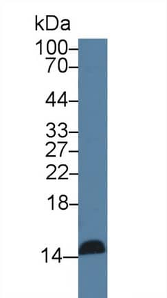 Western Blot: Reg3G Antibody (C15) [NBP3-41978] - Sample: Human Serum; Primary Ab: 3ug/ml NBP3-41978; Second Ab: 0.2ug/mL HRP-Linked Caprine Anti-Mouse IgG Polyclonal Antibody