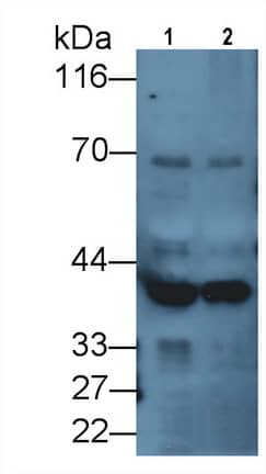 Western Blot: DCLK1 Antibody (C1) [NBP3-41980] - Sample: Lane1: Porcine Cerebrum lysate; Lane2: Rat Cerebrum lysate Primary Ab: 2ug/ml NBP3-41980; Second Ab: 0.2ug/mL HRP-Linked Caprine Anti-Mouse IgG Polyclonal Antibody