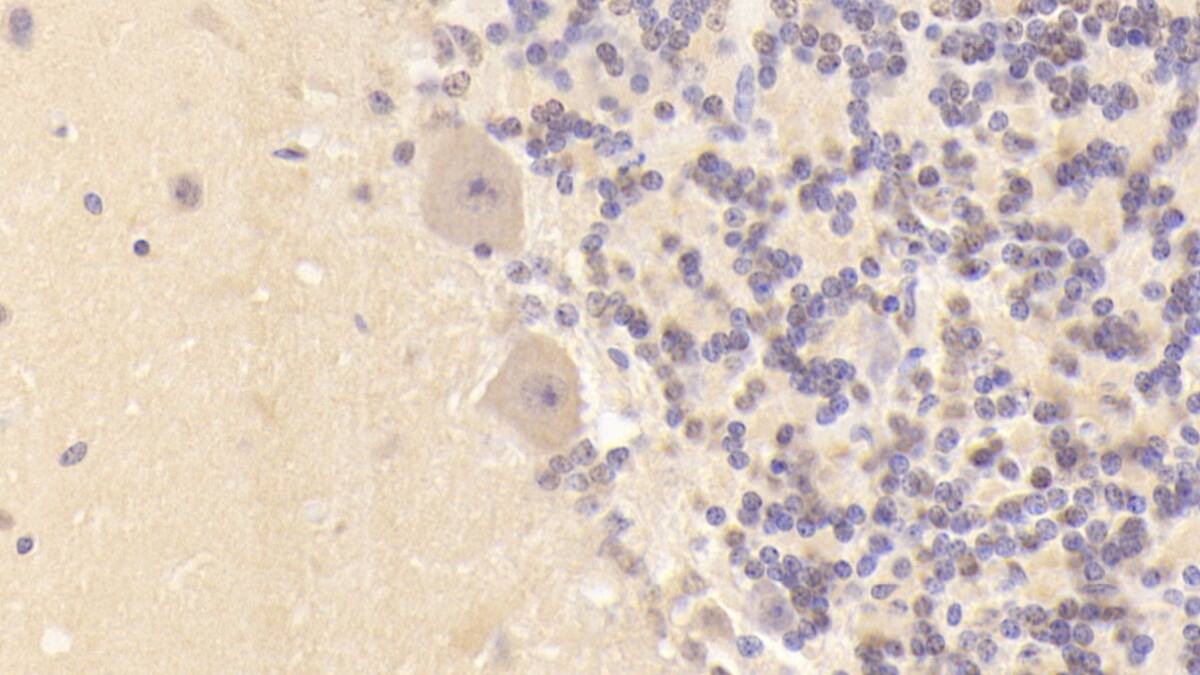 Immunohistochemistry-Paraffin: DCLK1 Antibody (C1) [NBP3-41980] - DAB staining on IHC-P; Sample: Human Cerebellum Tissue; Primary Ab: 30ug/ml NBP3-41980; Second Ab: 2ug/mL HRP-Linked Caprine Anti-Mouse IgG Polyclonal Antibody