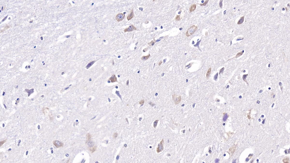 Immunohistochemistry-Paraffin: DCLK1 Antibody (C2) [NBP3-41982] - DAB staining on IHC-P; Sample: Human Cerebrum Tissue; Primary Ab: 20ug/ml NBP3-41982; Second Ab: 2ug/mL HRP-Linked Caprine Anti-Mouse IgG Polyclonal Antibody