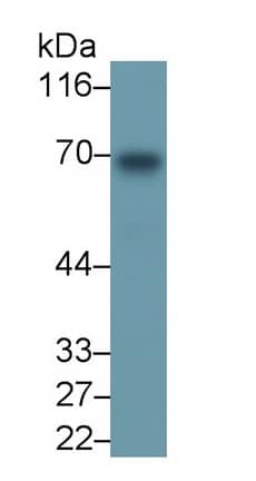 Western Blot: PADI4 Antibody (C17) [NBP3-41983] - Sample: Human Saliva Primary Ab: 1ug/ml NBP3-41983; Second Ab: 0.2ug/mL HRP-Linked Caprine Anti-Mouse IgG Polyclonal Antibody