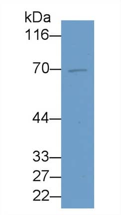 Western Blot: PADI4 Antibody (C17) [NBP3-41983] - Sample: Human Milk Primary Ab: 2ug/ml NBP3-41983; Second Ab: 0.2ug/mL HRP-Linked Caprine Anti-Mouse IgG Polyclonal Antibody