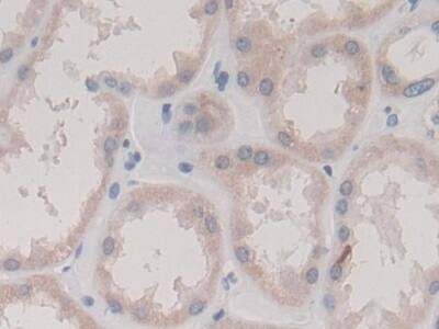 Immunohistochemistry-Paraffin: Collectrin/TMEM27 Antibody (C2) [NBP3-41984] - DAB staining on IHC-P; Sample: Human Kidney Tissue; Primary Ab: 30ug/ml NBP3-41984; Second Ab: 2ug/mL HRP-Linked Caprine Anti-Mouse IgG Polyclonal Antibody