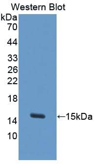 Western Blot: S100A7A Antibody [NBP3-41986] - Sample: Recombinant S100A7A, Human.