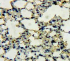 Immunohistochemistry-Paraffin: DEFB119 Antibody [NBP3-41988] - Used in DAB staining on fromalin fixed paraffin-embedded Lung tissue