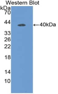 Western Blot: DEFB119 Antibody [NBP3-41988] - Sample: Recombinant protein.