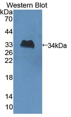 Western Blot SLFN5 Antibody - BSA Free