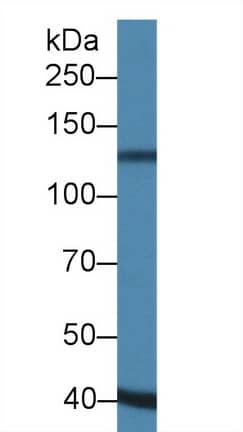 Western Blot ADAMTS19 Antibody - BSA Free