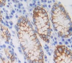 Immunohistochemistry-Paraffin B3GALT5 Antibody