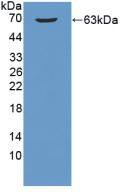 Western Blot B3GALT5 Antibody