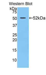 Western Blot: FUR1 Antibody [NBP3-41997] - Sample: Recombinant protein.