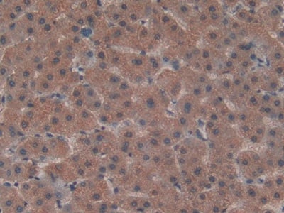 Immunohistochemistry-Paraffin: LRP5L Antibody [NBP3-41998] - DAB staining on IHC-P; Samples: Human Liver Tissue; Primary Ab: 20ug/ml NBP3-41998; Second Ab: 2ug/mL HRP-Linked Caprine Anti-Rabbit IgG Polyclonal Antibody