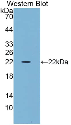 Western Blot: MAATS1 Antibody [NBP3-41999] - Sample: Recombinant protein.