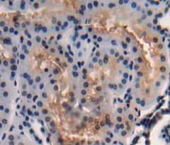 Immunohistochemistry-Paraffin: MAATS1 Antibody [NBP3-41999] - Used in DAB staining on fromalin fixed paraffin- embedded Kidney tissue