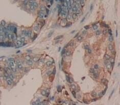 Immunohistochemistry-Paraffin: ADAMTS16 Antibody [NBP3-42002] - Used in DAB staining on fromalin fixed paraffin- embedded Kidney tissue