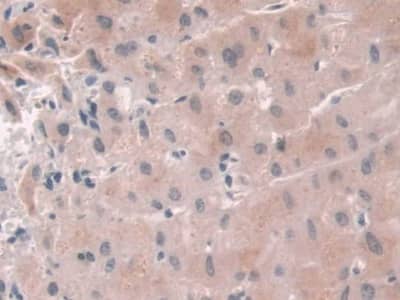 Immunohistochemistry-Paraffin USP6NL Antibody