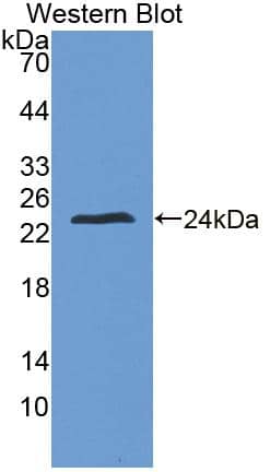 Western Blot ZFHX4 Antibody - BSA Free