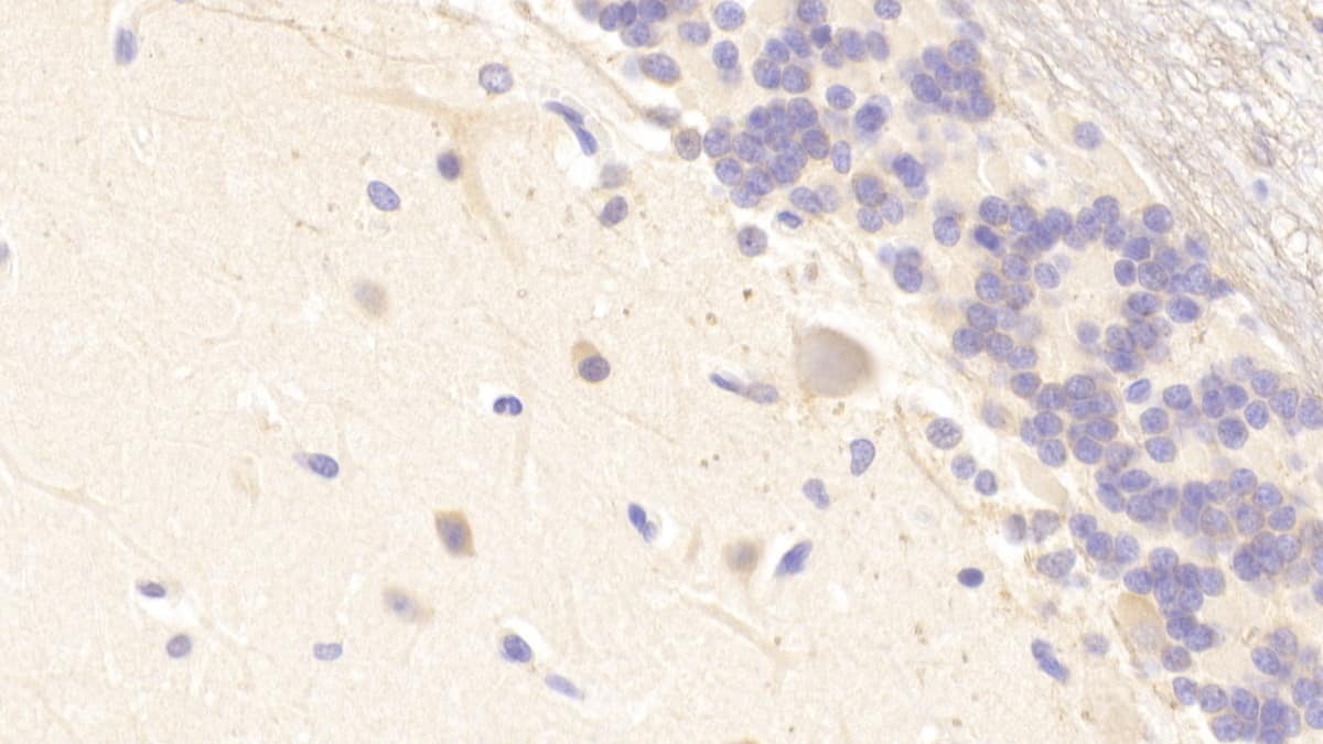 Immunohistochemistry-Paraffin MXRA5 Antibody