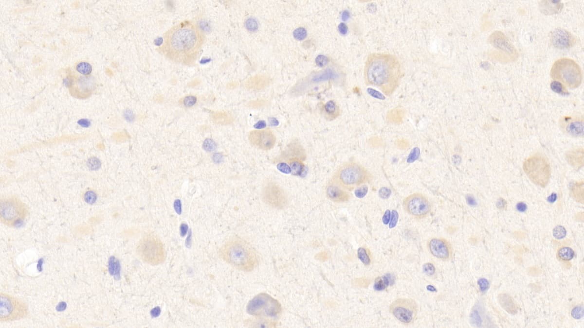 Immunohistochemistry-Paraffin MXRA5 Antibody