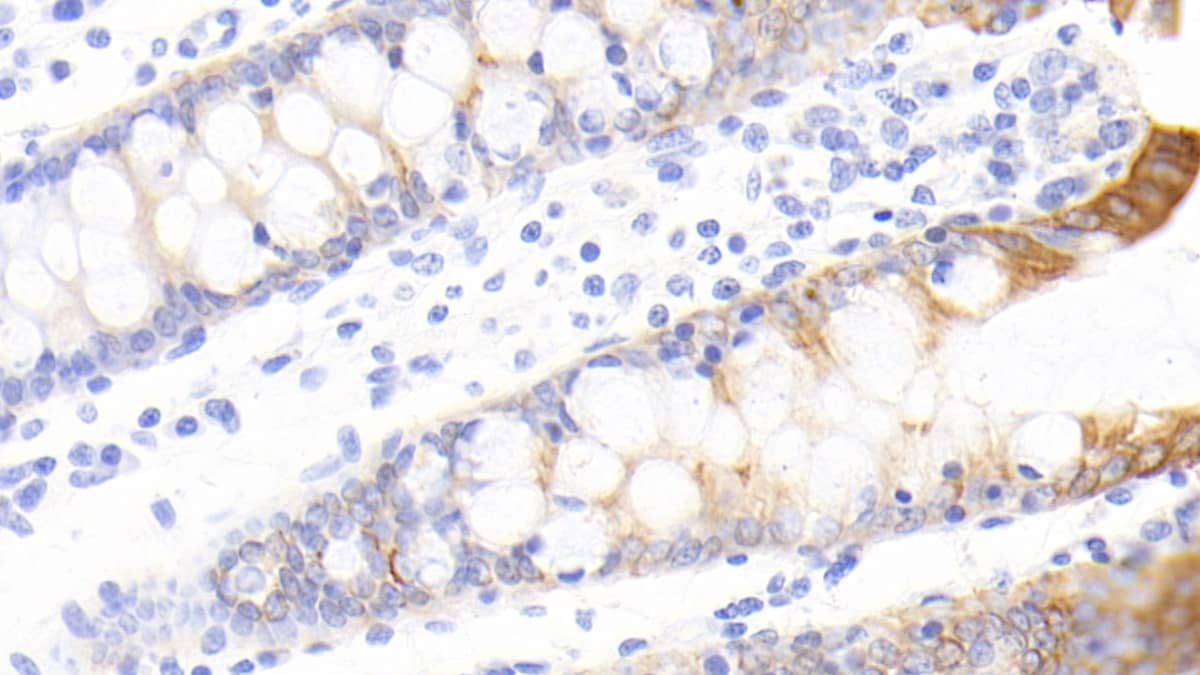 Immunohistochemistry-Paraffin FAM5C Antibody