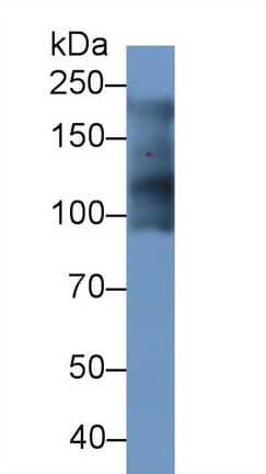 Western Blot MYH7B Antibody