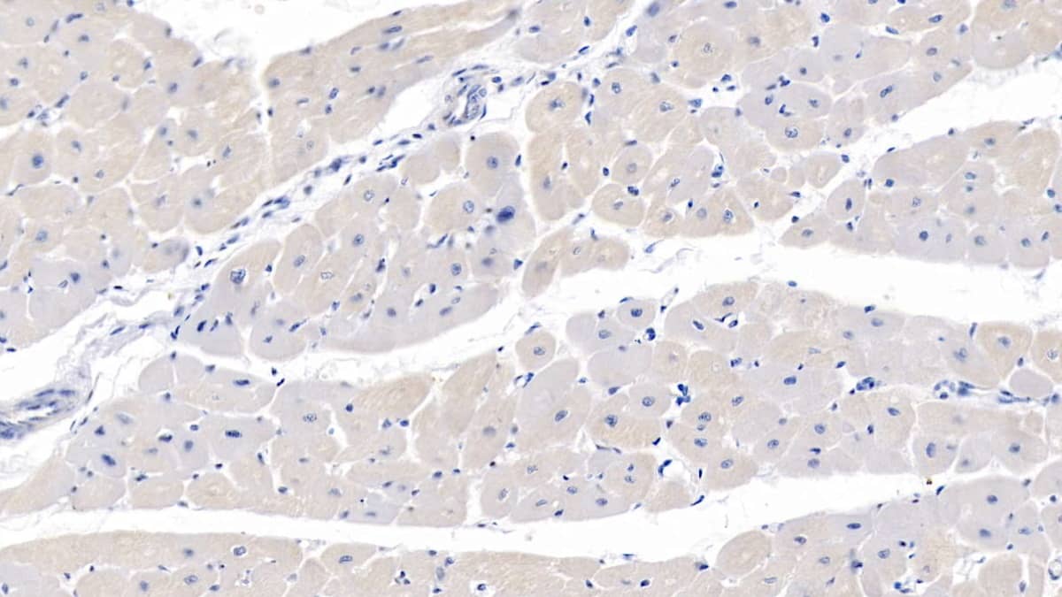 Immunohistochemistry-Paraffin MYH7B Antibody