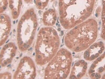 Immunohistochemistry-Paraffin ABCC10 Antibody