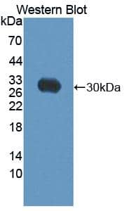 Western Blot ABCC10 Antibody