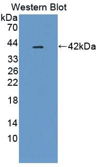 Western Blot PIM3 Antibody