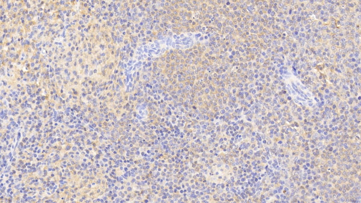 Immunohistochemistry-Paraffin PIM3 Antibody