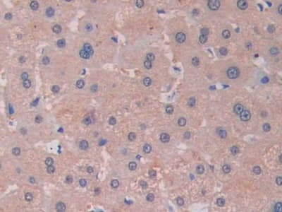 Immunohistochemistry-Paraffin: RNASE13 Antibody [NBP3-42028] - DAB staining on IHC-P; Samples: Human Liver Tissue; Primary Ab: 30ug/ml NBP3-42028; Second Ab: 2ug/mL HRP-Linked Caprine Anti-Rabbit IgG Polyclonal Antibody