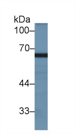 Western Blot: MX2 Antibody [NBP3-42029] - Sample: Rat Testis lysate; Primary Ab: 2ug/ml NBP3-42029; Second Ab: 0.2ug/mL HRP-Linked Caprine Anti-Rabbit IgG Polyclonal Antibody