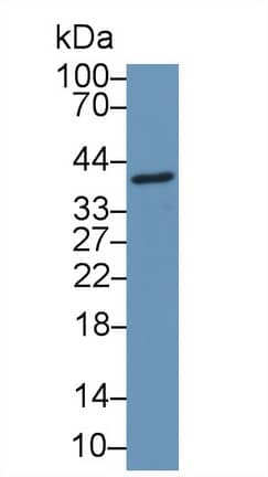 Western Blot: CCDC3 Antibody [NBP3-42044] - Sample: Mouse Gallbladder lysate; Primary Ab: 1ug/ml NBP3-42044; Second Ab: 0.2ug/mL HRP-Linked Caprine Anti-Rabbit IgG Polyclonal Antibody;