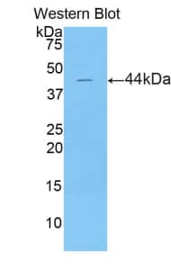 Western Blot: LCN15 Antibody [NBP3-42047] - Sample: Recombinant protein.