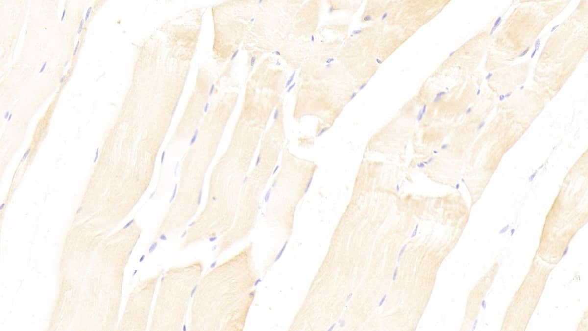 Immunohistochemistry-Paraffin: Neuropilin-2 Antibody (D13) [NBP3-42051] - DAB staining on IHC-P; Sample: Rat Skeletal muscle Tissue; Primary Ab: 20ug/ml NBP3-42051; Second Ab: 2ug/mL HRP-Linked Caprine Anti-Mouse IgG Polyclonal Antibody