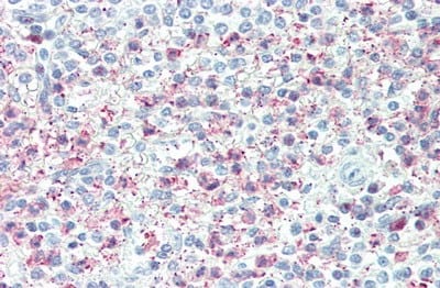 Immunohistochemistry-Paraffin: TSG-6 Antibody [NBP3-42052] - Vector Red staining on IHC-P; Samples: Human Spleen Tissue; Primary Ab: 20ug/ml NBP3-42052; Second Ab: 2ug/mL HRP-Linked Caprine Anti-Rabbit IgG Polyclonal Antibody