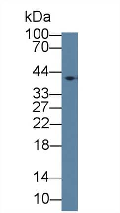 Western Blot: EPHX4 Antibody [NBP3-42053] - Sample: Mouse Cerebrum lysate; Primary Ab: 1ug/ml NBP3-42053; Second Ab: 0.2ug/mL HRP-Linked Caprine Anti-Rabbit IgG Polyclonal Antibody
