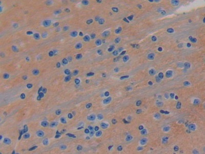 Immunohistochemistry-Paraffin: LRIG3 Antibody [NBP3-42056] - DAB staining on IHC-P; Samples: Mouse Brain Tissue